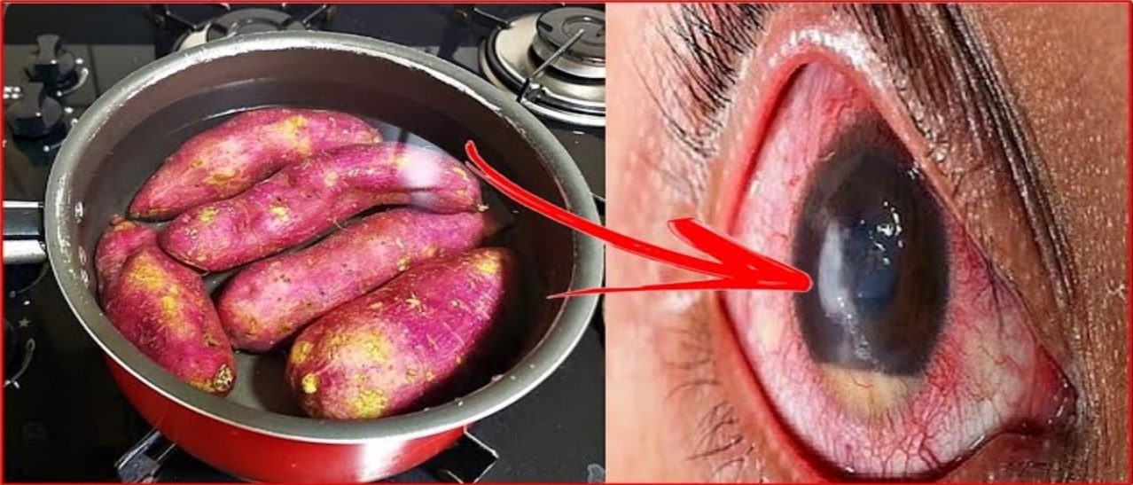 Como a batata doce pode promover a saúde dos seus olhos; Receita ...